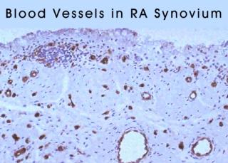 3synovium Blood vessels.jpg (17796 bytes)